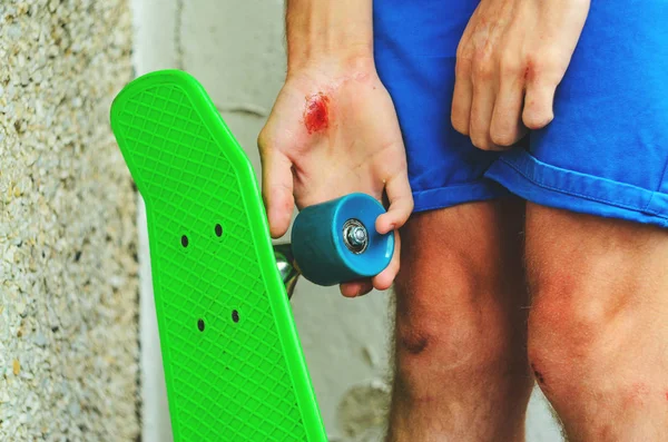 Cedera dalam olahraga ekstrim — Stok Foto