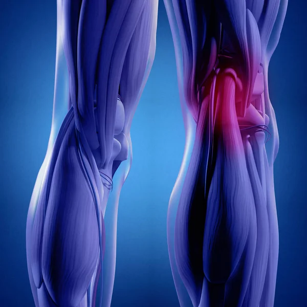 人类背后的腿解剖 — 图库照片