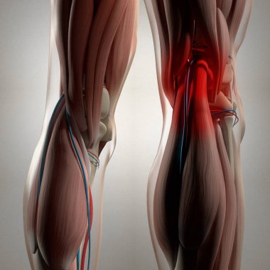Human Back of legs anatomy clipart