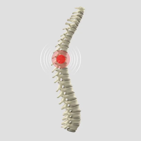 Modelul coloanei vertebrale umane — Fotografie, imagine de stoc