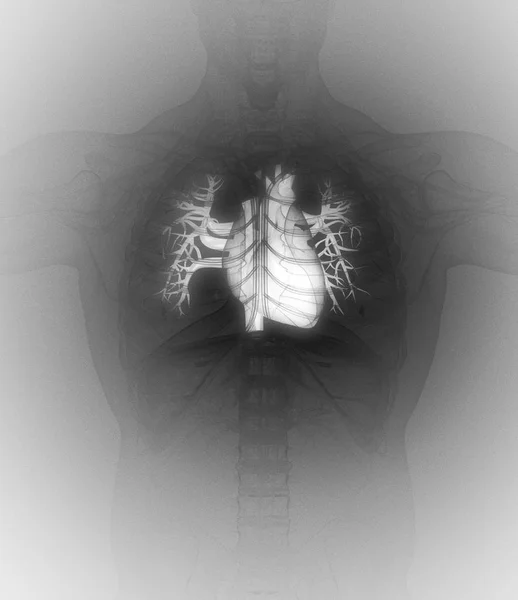 인간의 심장 해부학 모델 — 스톡 사진