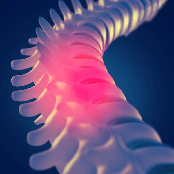 Human spine model — Stock Photo, Image