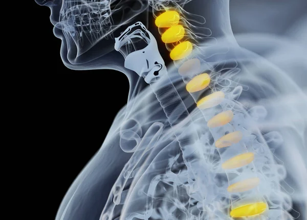 Human spine discs anatomy model — Stock Photo, Image