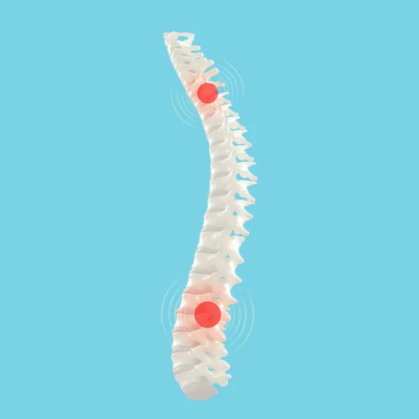 Modelo de columna vertebral humana —  Fotos de Stock