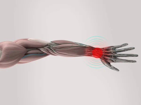 Modelu anatomii ludzkiego ramienia — Zdjęcie stockowe