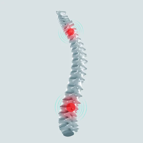 Modelo da coluna vertebral humana — Fotografia de Stock