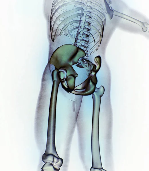 Ilium-Anatomie-Modell — Stockfoto