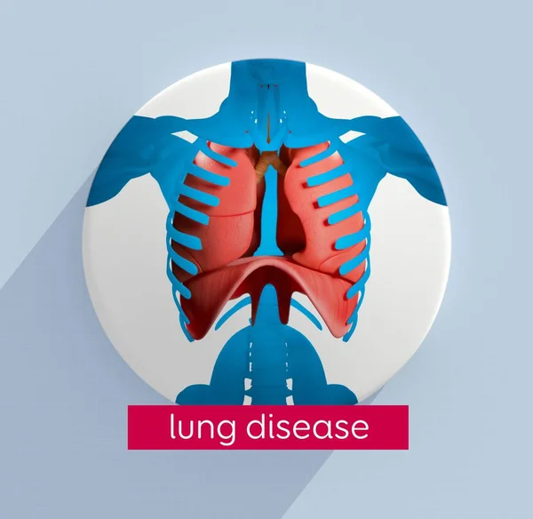 Anatomie-Modell der menschlichen Lunge — Stockfoto