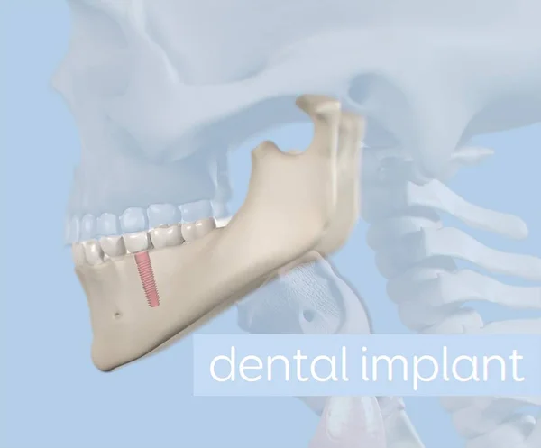 인간 치아 해부학 모델 — 스톡 사진