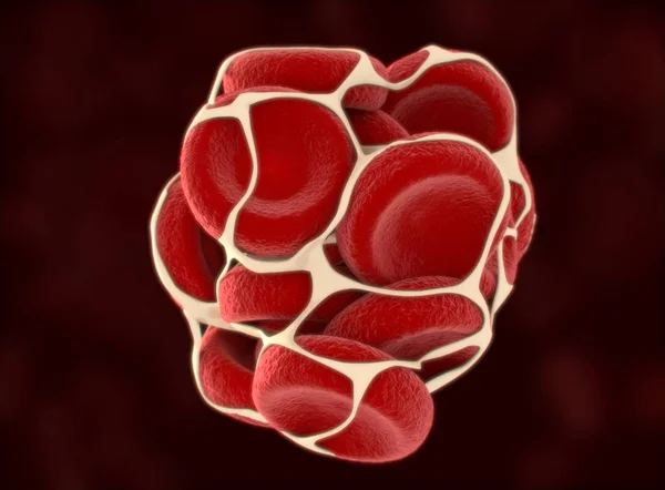 Blood clot model — Stock Photo, Image