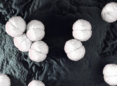 Neisseria meningitidis veya Meningokoksik bakteri