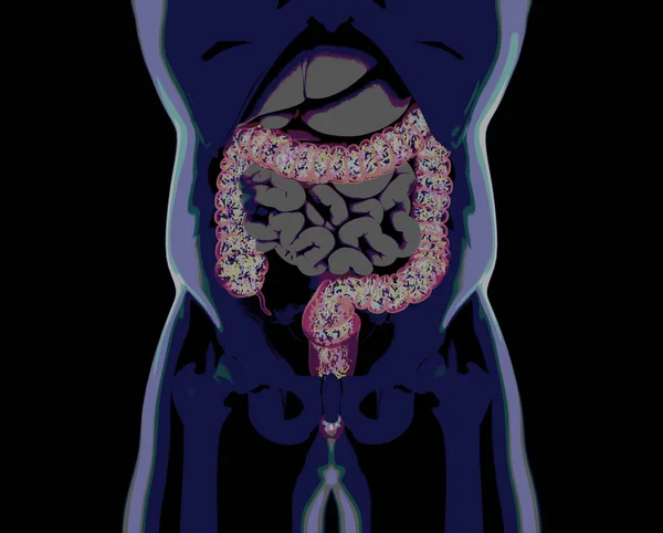Gut bacteria, microbiome. Bacteria inside the large intestine, c — Stock Photo, Image