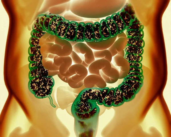 Bacterias intestinales, microbioma. Bacterias dentro del intestino grueso, c —  Fotos de Stock