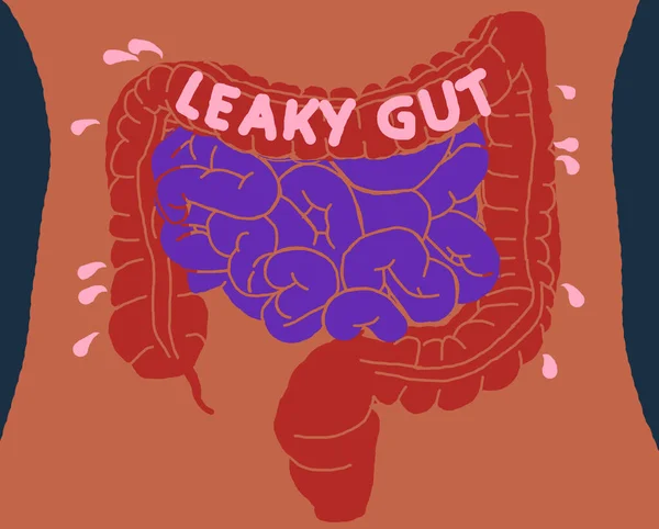 Intestines Body Showing Gut Bacteria Small Intestine Illustration — Stock Photo, Image