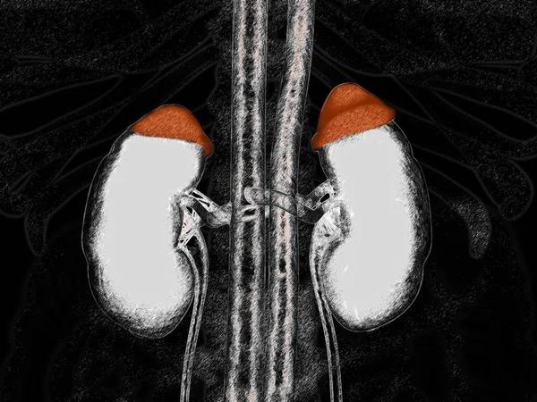 Bijnieren Rood Nieren Geïllustreerde Röntgenfoto Zoals Afbeelding Illustratie — Stockfoto