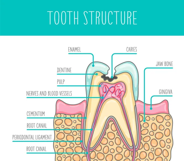 Illustrazione Vettoriale Una Struttura Dentale Umana Malata Illustrazione Adatta Manifesti — Vettoriale Stock