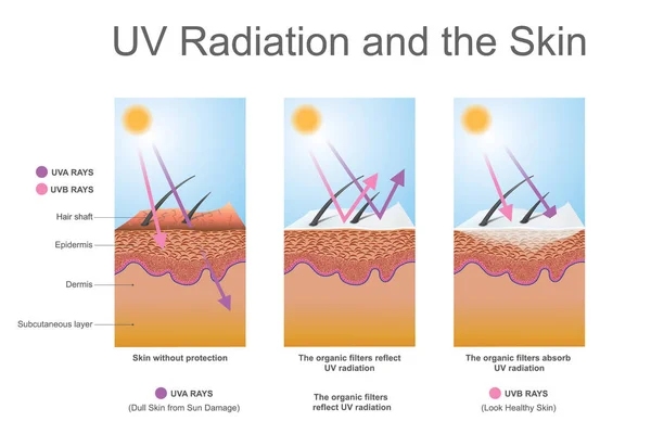 Le rayonnement UV et la peau . — Image vectorielle