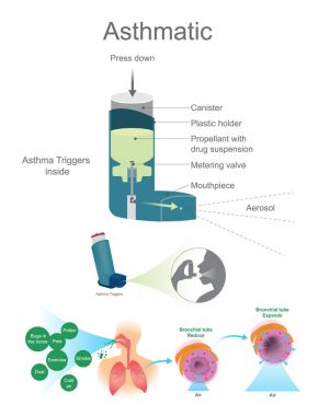 Asthmatic Airway. Asthma Triggers inside view. clipart