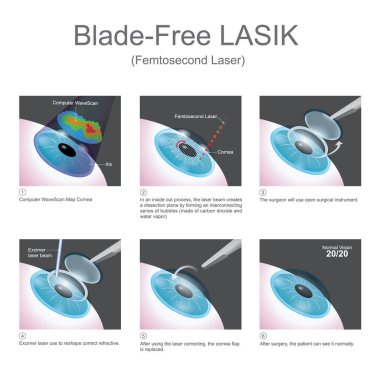 Blade ücretsiz Lasik. Vektör grafiği.