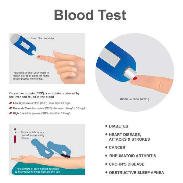 Krevní test laboratorní analýzy. Grafický vektorový obrázek. — Stockový vektor