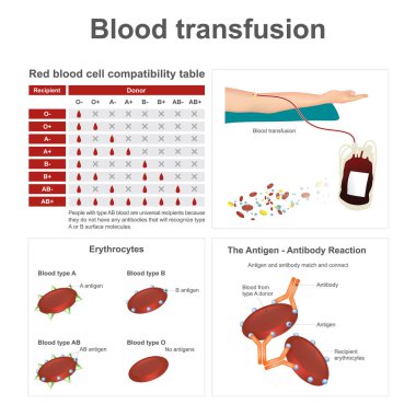 Blood transfusion. There are two special blood types when it comes to blood transfusions. Info graphic vector. clipart