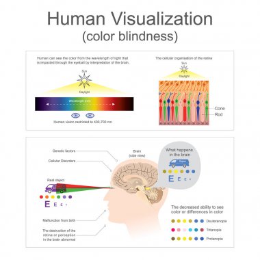 Human Visualization Color blindness. clipart