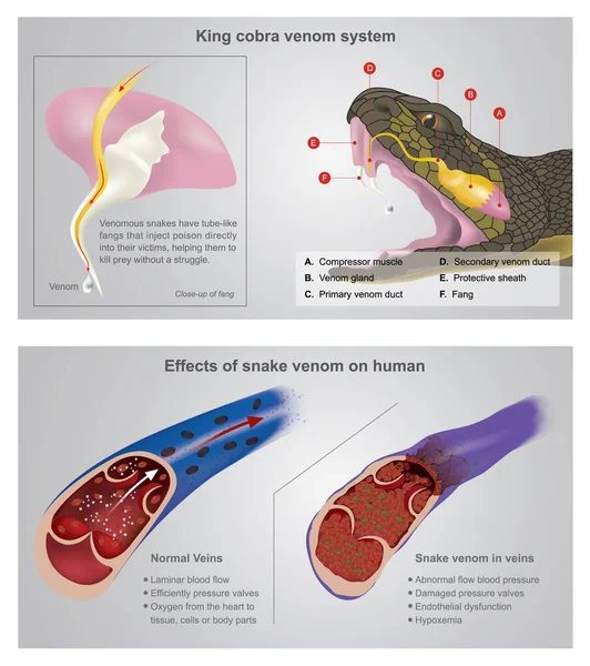 Efecto del veneno de serpiente en humanos. Info ilustración gráfica . — Vector de stock