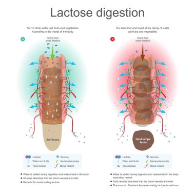 Lactose digestion. Water is added during digestion and reabsorb in the body. Bacteria fermenter eating lactose. Toxic residue absorbed into blood vessels and cells. Illustration anatomy. clipart