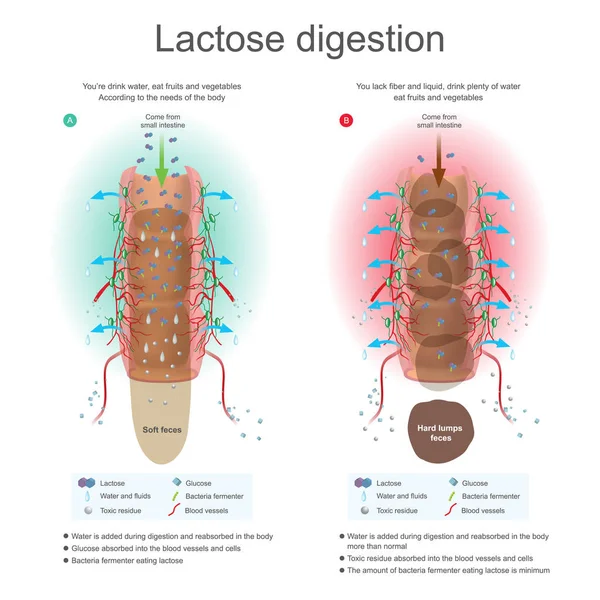 Digestión de lactosa. El agua se añade durante la digestión y se reabsorbe en el cuerpo. Fermentador bacteriano que come lactosa. Residuo tóxico absorbido por los vasos sanguíneos y las células. Anatomía ilustrativa . — Vector de stock