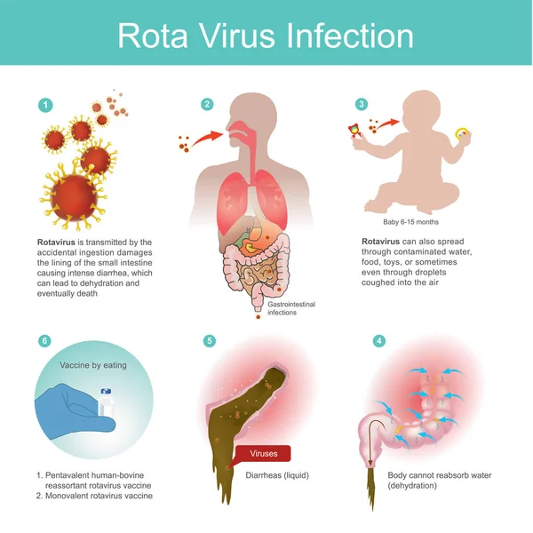 ロタウイルスは、誤飲によって送信されます。 — ストックベクタ