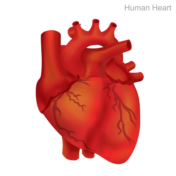 Corazón humano aislado. La angioplastia es un procedimiento endovascular para ensanchar arterias u venas estrechas u obstruidas, típicamente para tratar la aterosclerosis arterial. — Archivo Imágenes Vectoriales