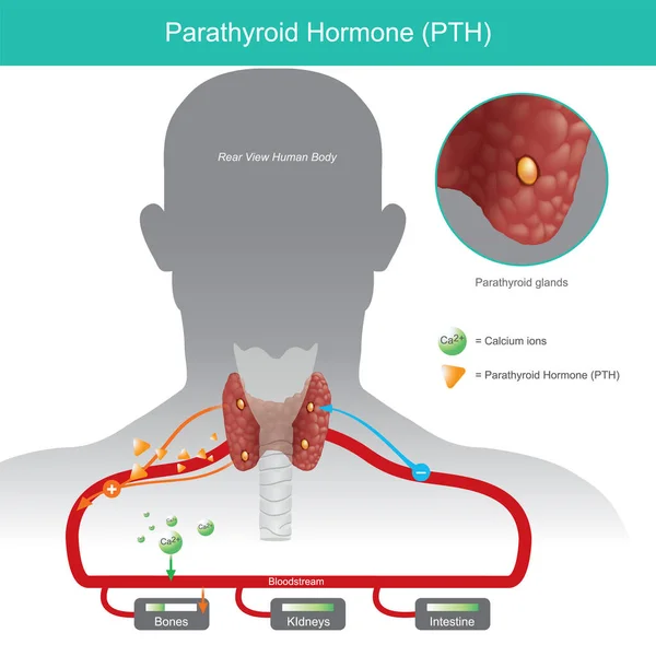 甲状旁腺激素 当甲状旁腺激素 Parathyroid Hormone Pth 水平较低时 可以通过增加钙含量来控制血液中的钙含量 说明1 — 图库矢量图片