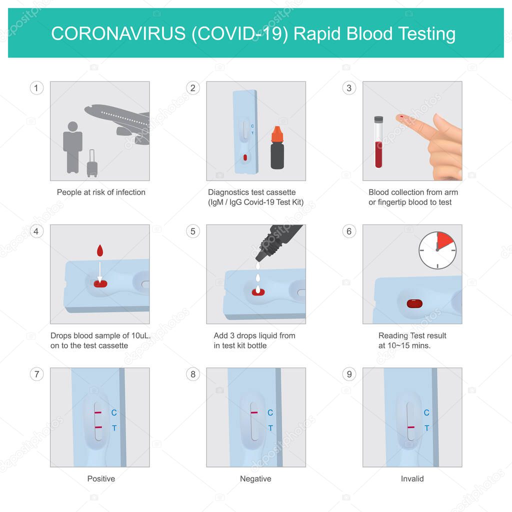 CORONAVIRUS Rapid Blood Testing. The method used for Test Kit CORONAVIRUS (COVID-19) in people at risk of infection by quick results
