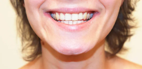 Muchacha sonriente de cerca. Dientes blancos sanos de cerca . —  Fotos de Stock