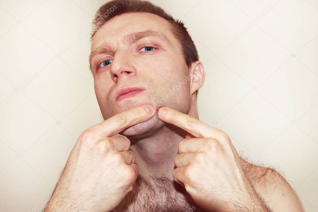 A man presses a pimple, bad skin on a white background.