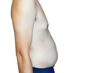 Adam daha fazla damar tıkamak olasıdır, Göbek Yağ, whi izole