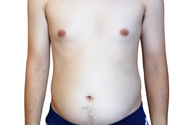 Мужчина чаще забивает артерии, толстяк с большим животом . — стоковое фото