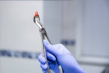 Diş metalik forseps çekti