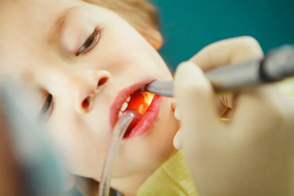Close up tiro de menino na cadeira do dentista durante a perfuração e tratamento dentário . — Fotografia de Stock