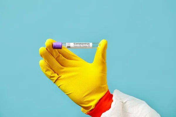 Visão de perto do trabalhador médico em luva protetora mantém um tubo de teste médico com um teste expresso para coronavírus. Síndrome respiratória do vírus epidémico. China, Wuhan . — Fotografia de Stock