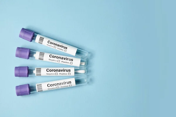 Tubos de ensaio médicos com um teste de coronavírus em fundo azul. Testes para determinar o vírus covid-19 . — Fotografia de Stock