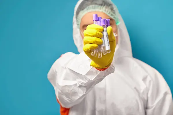 ウイルス性疾患コロナウイルスのための検査医療チューブを保持している医師のクローズアップショット. — ストック写真
