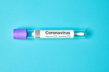 Coronavirus Covid 19 'un numunesi mavi arka planda tıbbi tüpte..