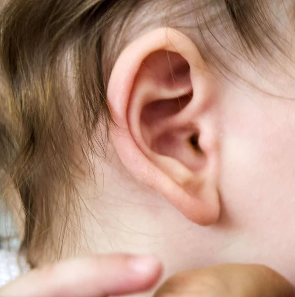 Winter Inflamed Much Children Ears Middle Ear Infections Medical Treatment — Stock Photo, Image