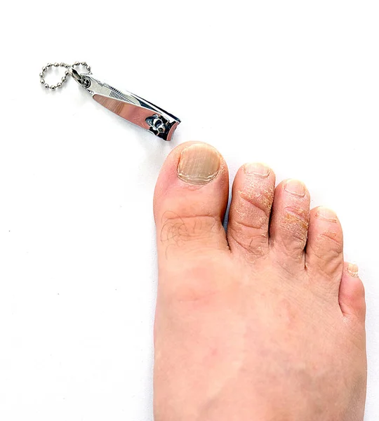 Ένα Άτομο Που Κόβει Νύχια Ποδιών Καθαρίζει Νύχια — Φωτογραφία Αρχείου