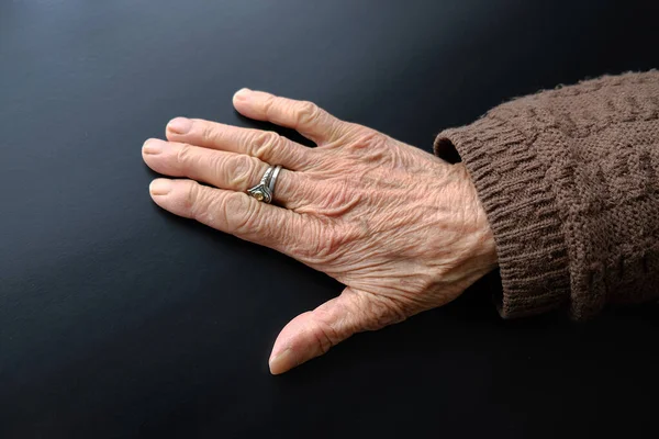 Jahre Alte Frauenhand Alte Menschenhand Mit Adern — Stockfoto