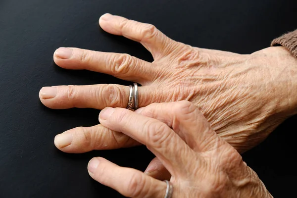 Jahre Alte Frauenhand Alte Menschenhand Mit Adern — Stockfoto