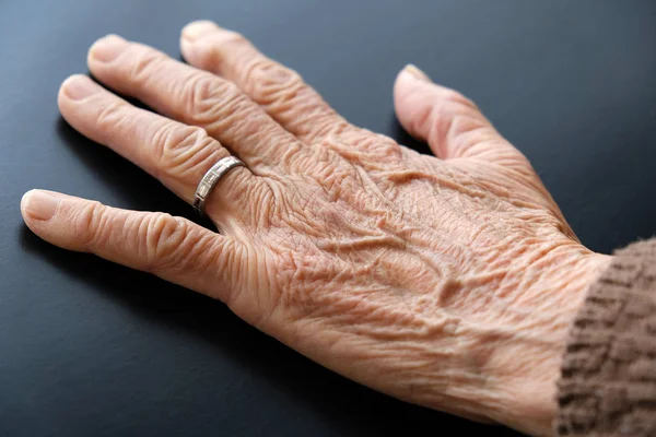 Die Hand Einer Älteren Frau Mit Einem Ring Finger Die — Stockfoto