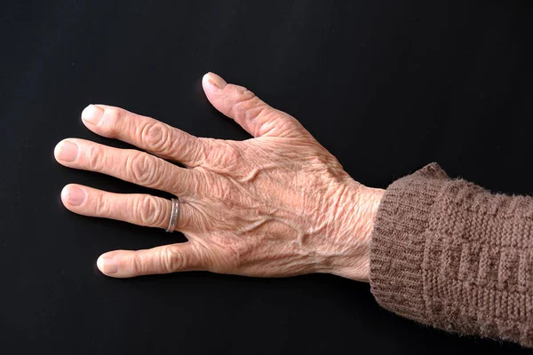 Die Hand Einer Älteren Frau Mit Einem Ring Finger Die — Stockfoto