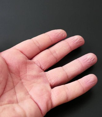 Suda kalan parmak kırışıklıkları, su yüzünden buruşmuş parmak uçları.,